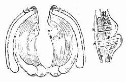 声门损伤手术方法