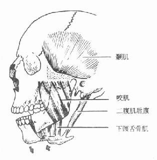 颏孔部骨折后骨折段移位情况