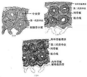 骨密质改建示意图 