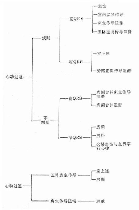 根据心电图特征提示的心律失常诊断表
