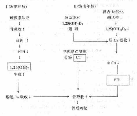 原发性骨质疏松症发病机理