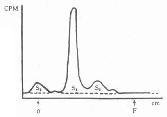 放射层析扫描面积计算比活度示意图