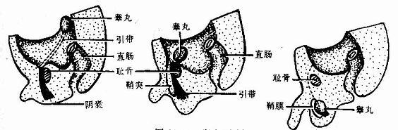 睾丸下降 