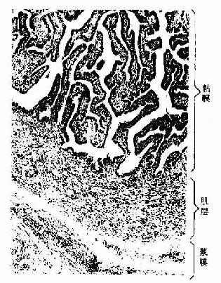 人输卵管壶腹部