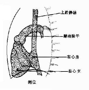 正常腔静脉,右心房、室造影示意图