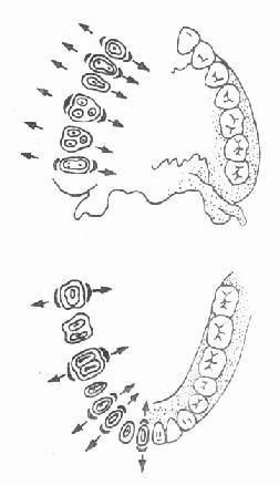 用牙钳拔牙时的摇动方向示意图