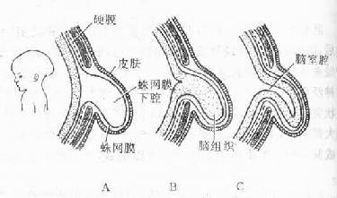 几种脑部畸形