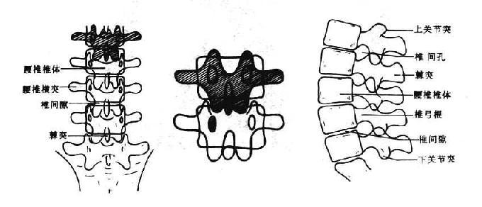 正常腰椎正侧位