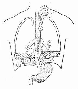 自发性食管破裂部位