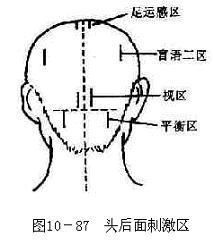 头后面刺激区