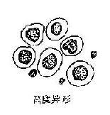 各种异形间皮细胞