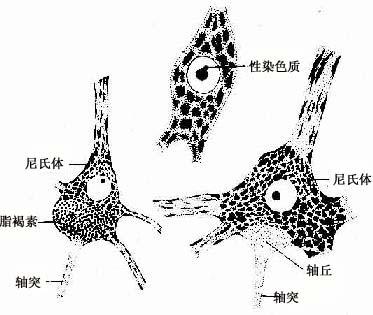 神经元胞体光镜结构，示尼氏体