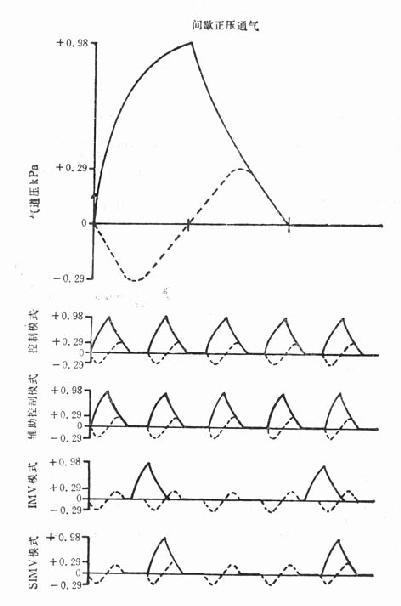几种通气模式的典型气道压力曲线